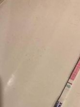 恭喜试管成功，试管婴儿移植成功6大症状详解